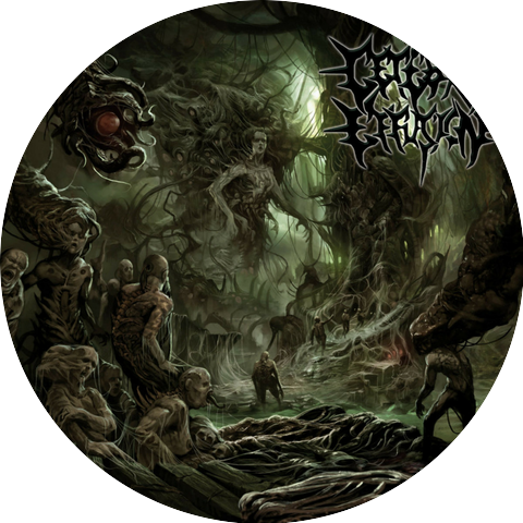 Cerebral Effusion