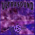 Ultrasound