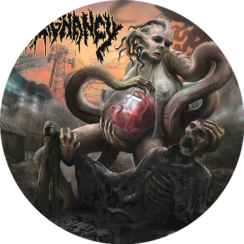 Malignancy