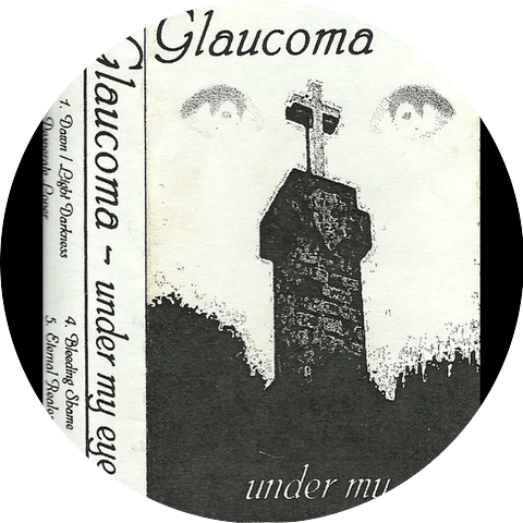 Glaucoma