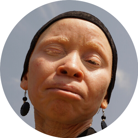 Tanzania Albinism Collective