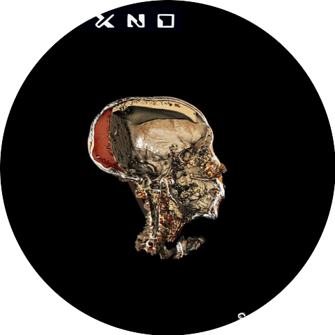 Ryxno