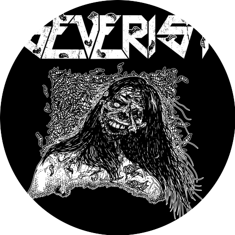Severist