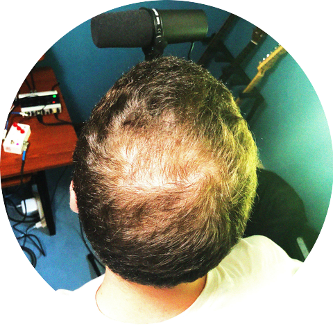 the amnesiacs & the amnesiacs