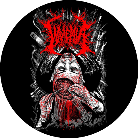 Viraemia