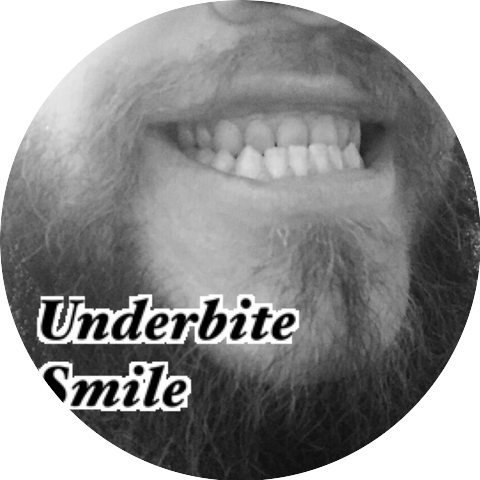 Underbite Smile