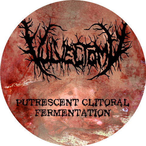 Vulvectomy
