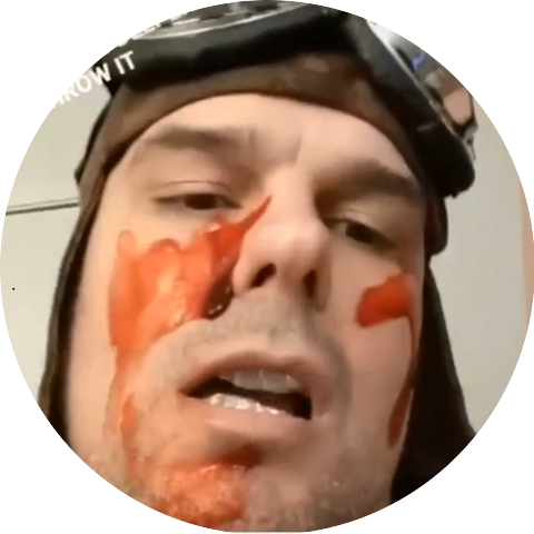 Anonymous Rapper da 1