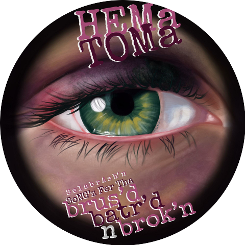 Hematoma