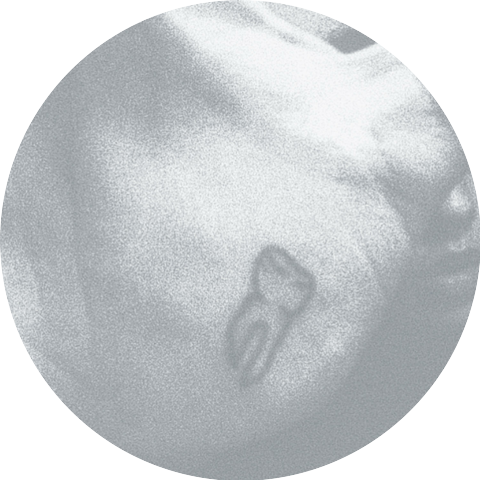yxng teeth