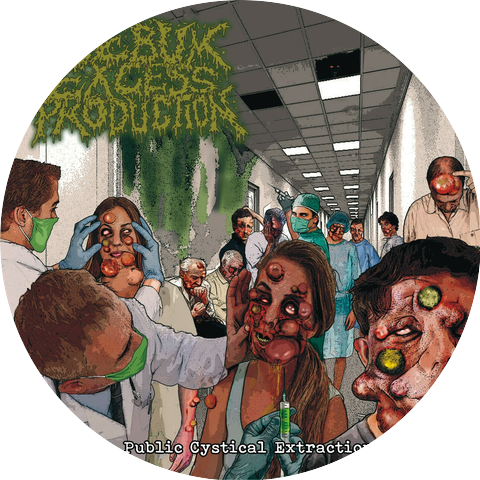Sebum Excess Production