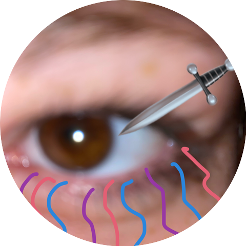 Wild Singing Kangaroos