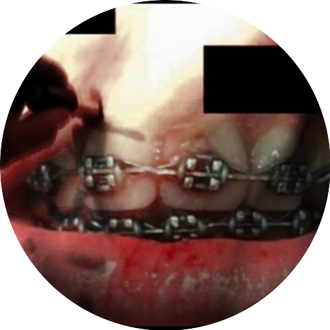 AD0RKEN