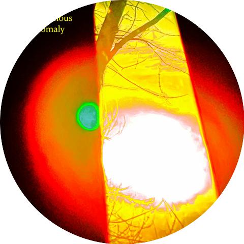 Autonomous Anomaly