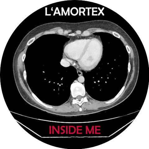 L' Amortex