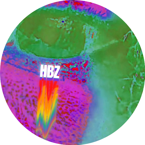 HazardBøy Zea