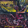 Hemoptysis