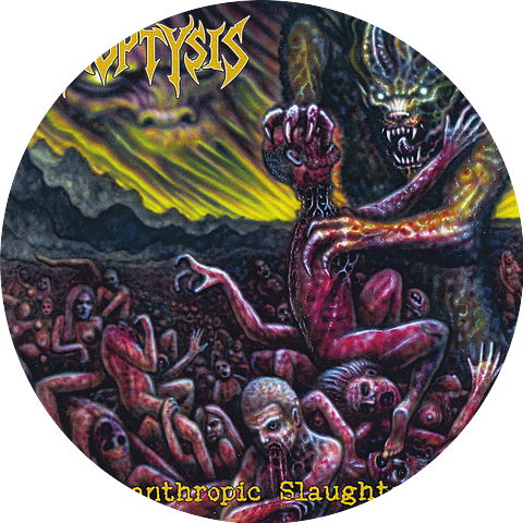Hemoptysis