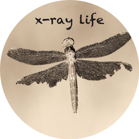 X-Ray Life