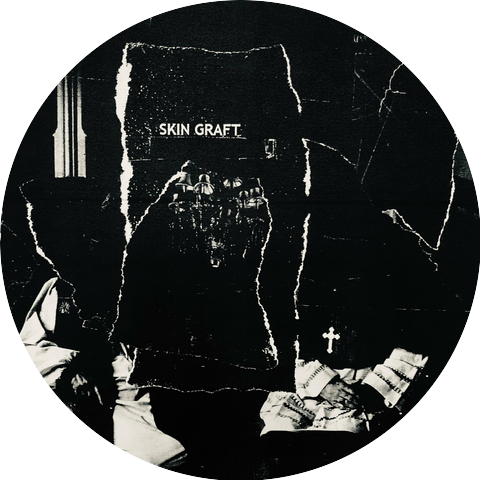 Skin Graft