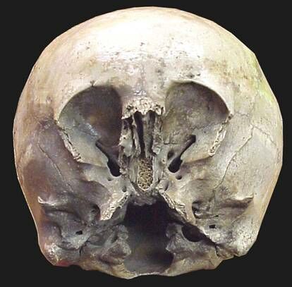 Starchild Skull in the News...