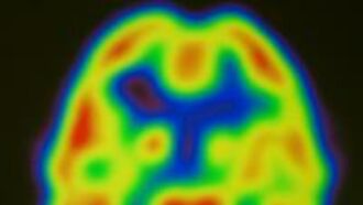 Any Belief Lights Up Brain