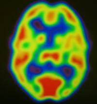 Any Belief Lights Up Brain