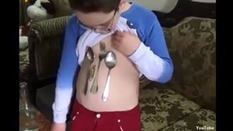 Syrian Boy Boasts Magnetic Belly?