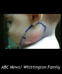 Feather Emerges Out of Baby's Neck