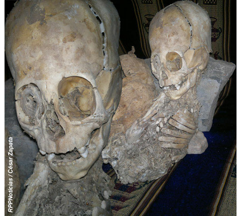 Is this an alien skull?