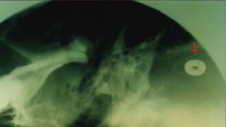 Alien Implants: Photo & Video