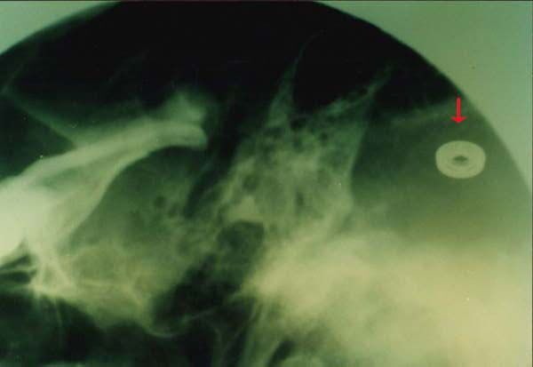 Alien Implants: Photo & Video