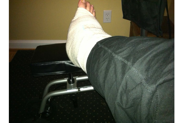 Ian's Post-Surgery Ankle