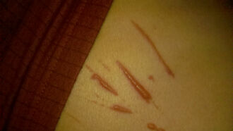 Scratched by an Entity?