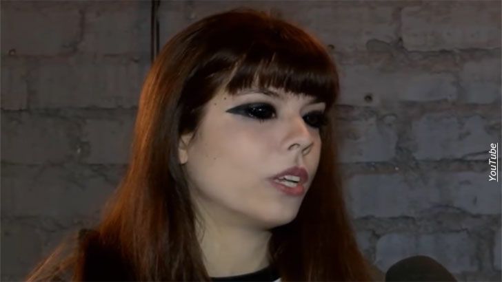 Woman Faces Blindness After Getting Eyeballs Dyed Black