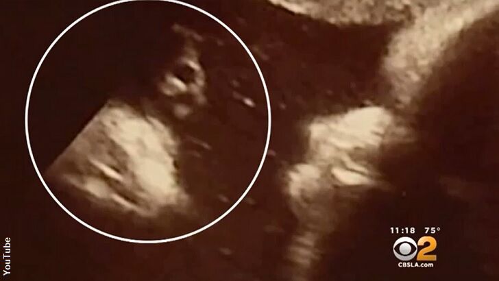 Couple Believes Baby's Sonogram Shows Jesus' Face