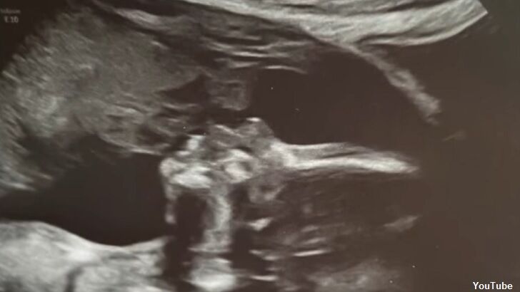 Video: Woman Believes Ultrasound Shows Her Late Father Kissing Baby