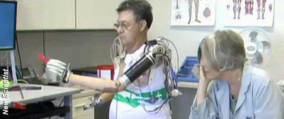 Mind-Controlled Bionic Arm