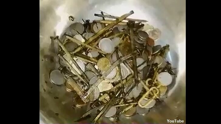 Indian Man Ingests Incredible Number of Coins and Nails