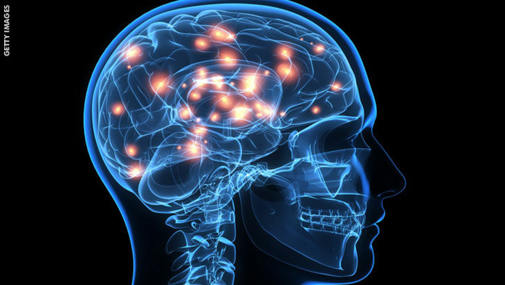 Are Rich Americans Getting Secret Brain Implants?