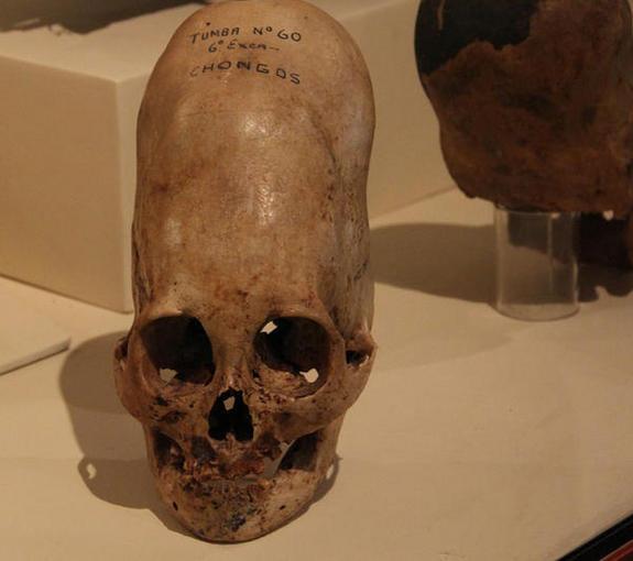 Elongated Skulls From Peru | Coast to Coast AM