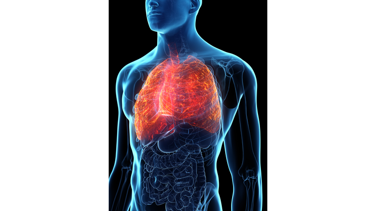 Diseased lung, conceptual illustration