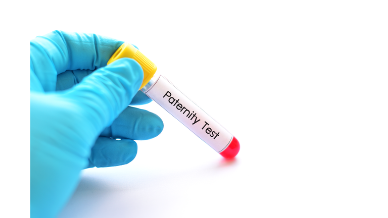 Blood sample for paternity test