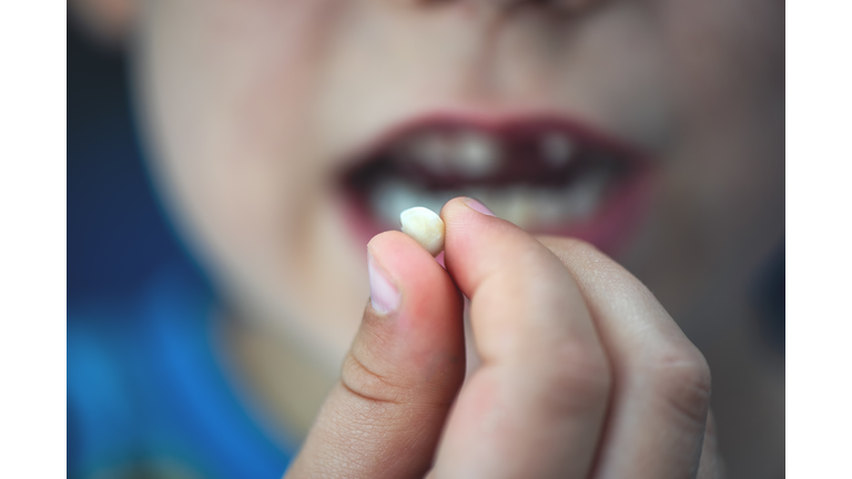 Proud young boy (age 6) holds his falling milk teeth. Childhood healthcare concept. Real people.