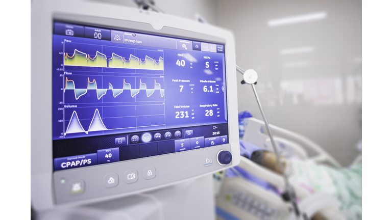 Ventilator monitor ,given oxygen by intubation tube to patient, setting in ICU/Emergency room