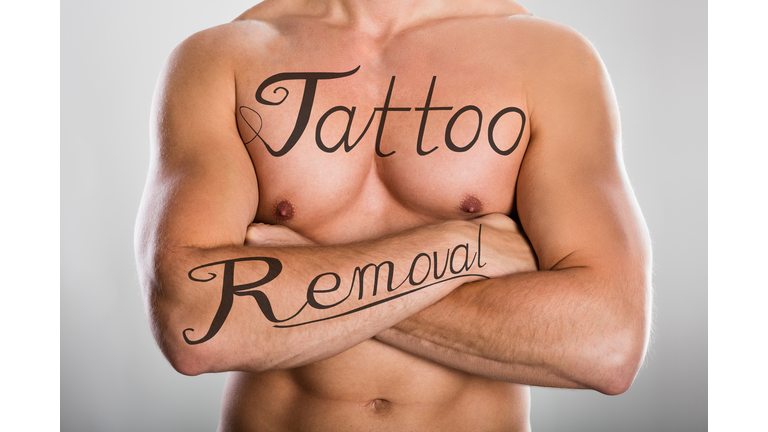 Tattoo Removal Text On Man's Chest And On His Arm