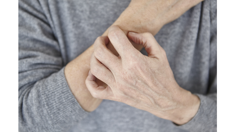 Senior woman scratching arm, close-up