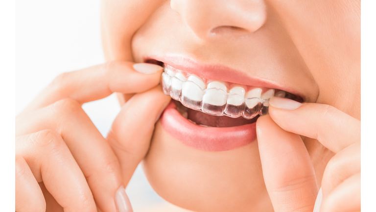 Beautiful smile and white teeth of a young woman.