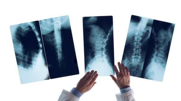 Radiologist shortage delaying test results in West MI