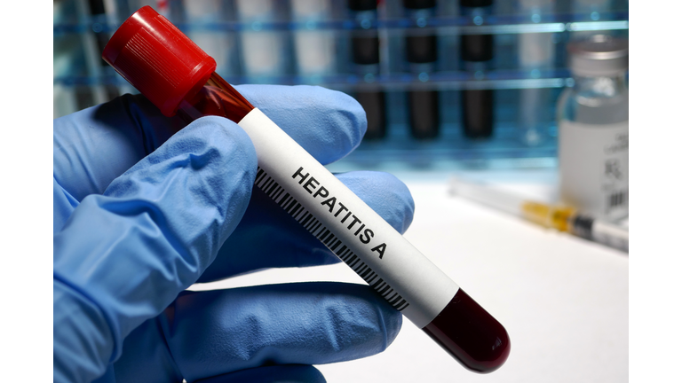 Hepatitis A treatment